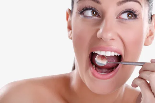 Blanqueamiento Dental Fuengirola Costa del Sol